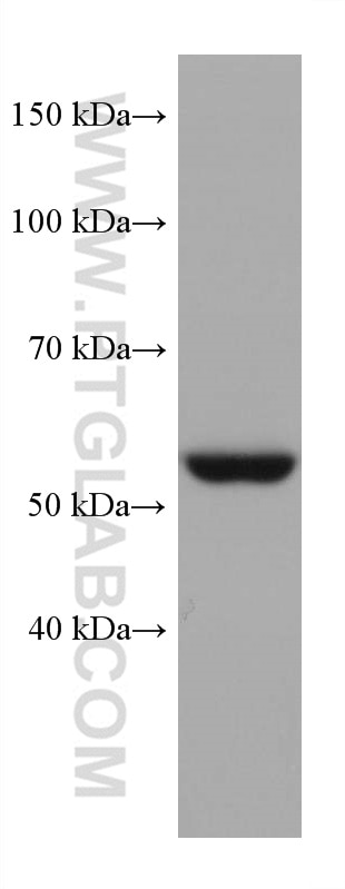 Western Blot (WB) analysis of HeLa cells using STK11/LKB1 Monoclonal antibody (68016-1-Ig)