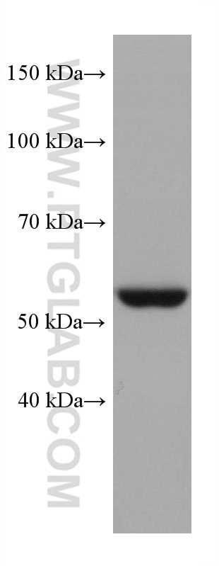 WB analysis of HeLa using 68016-1-Ig