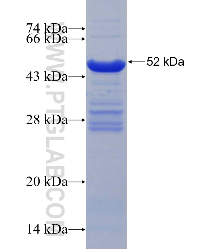STK11 fusion protein Ag30903 SDS-PAGE