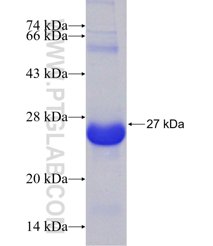 STK11 fusion protein Ag30915 SDS-PAGE STK11 fusion protein Ag30915 SDS-PAGE