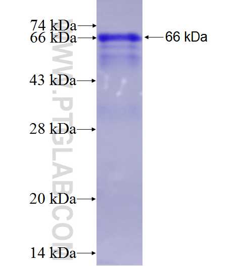 STK11 fusion protein Ag1048 SDS-PAGE