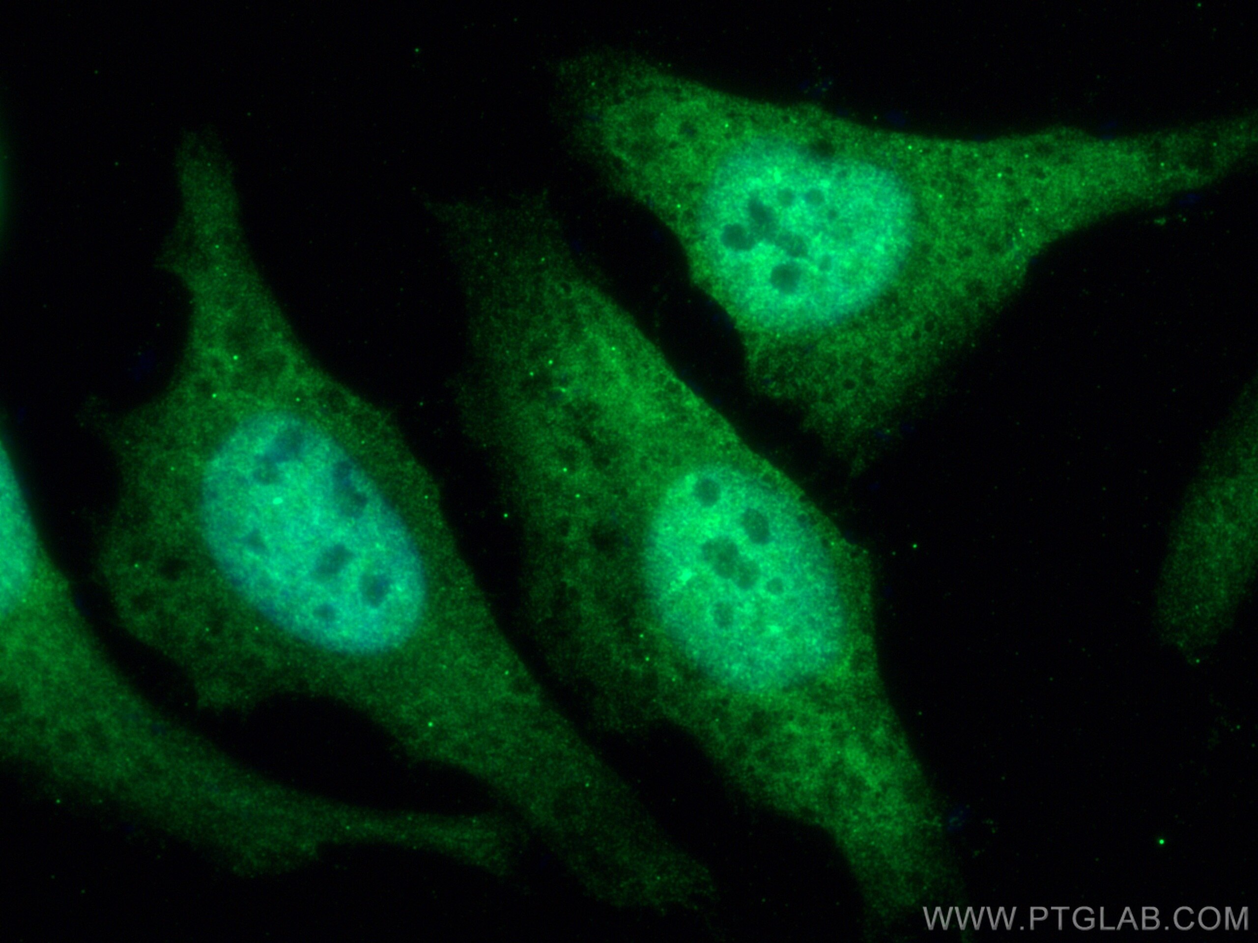Immunofluorescence (IF) / fluorescent staining of HeLa cells using STK11/LKB1 Polyclonal antibody (29323-1-AP)