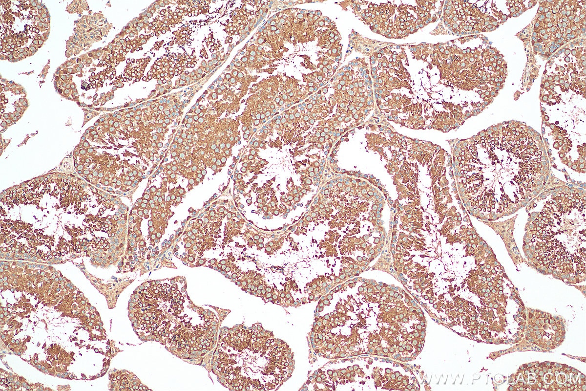 Immunohistochemistry (IHC) staining of mouse testis tissue using STK11/LKB1 Polyclonal antibody (29323-1-AP)