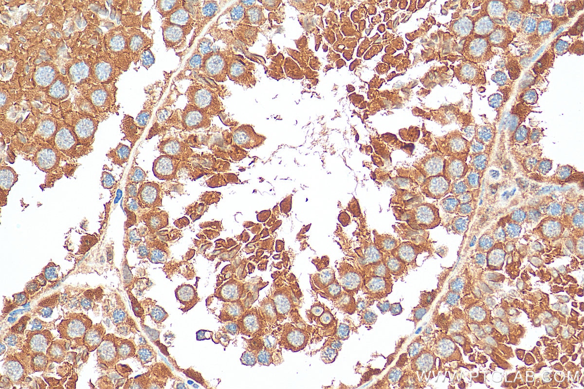 Immunohistochemistry (IHC) staining of mouse testis tissue using STK11/LKB1 Polyclonal antibody (29323-1-AP)