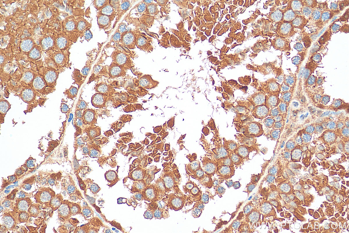 IHC staining of mouse testis using 29323-1-AP