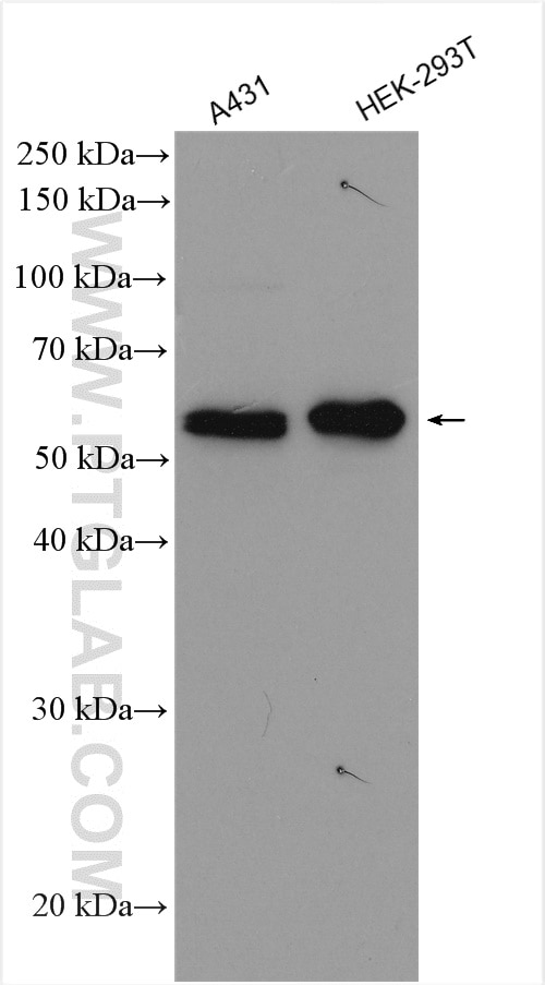 Western Blot (WB) analysis of various lysates using STK11/LKB1 Polyclonal antibody (29323-1-AP)