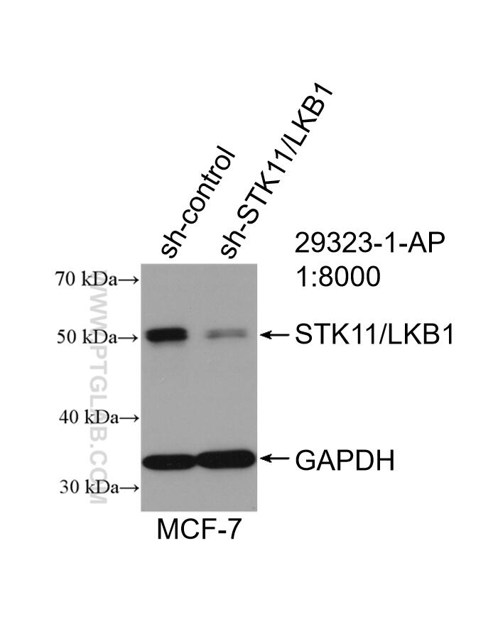 Western Blot (WB) analysis of MCF-7 cells using STK11/LKB1 Polyclonal antibody (29323-1-AP)