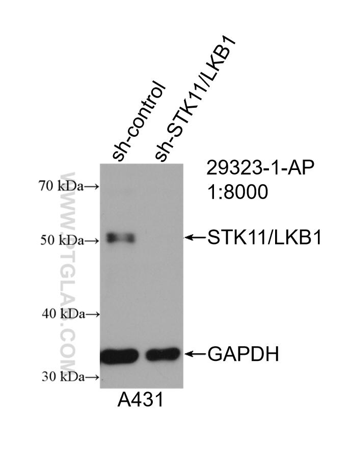 Western Blot (WB) analysis of A431 cells using STK11/LKB1 Polyclonal antibody (29323-1-AP)