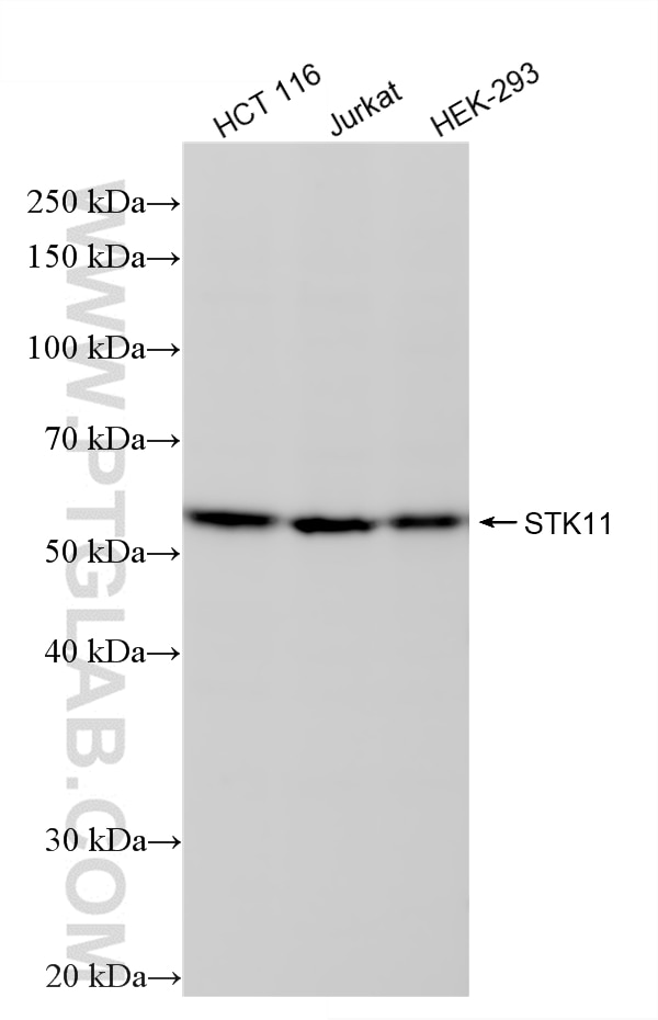 WB analysis using 88058-4-RR Western Blot (WB) analysis of various lysates using STK11/LKB1 Recombinant monoclonal antibody (88058-4-RR)
