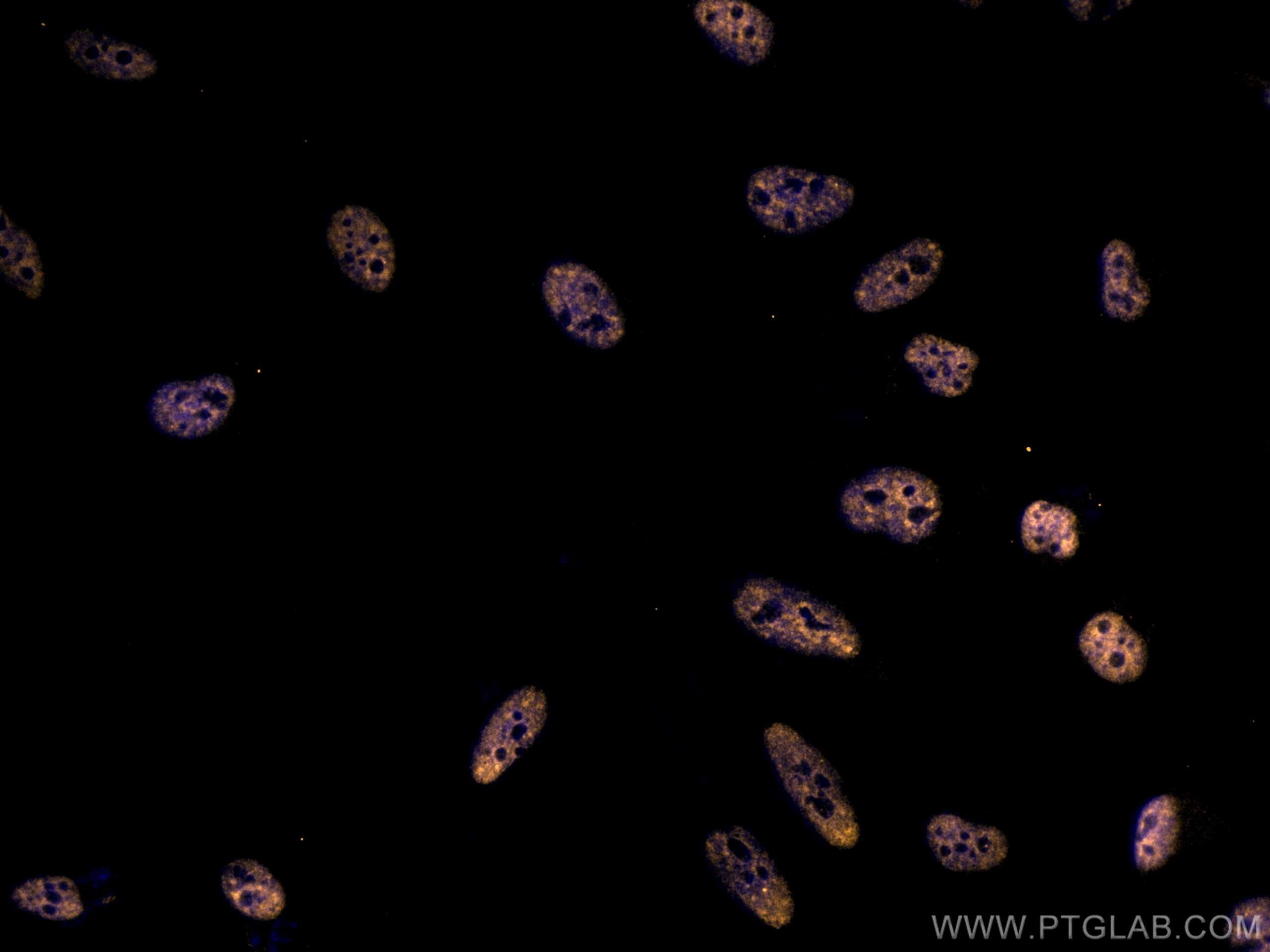 Immunofluorescence (IF) / fluorescent staining of HeLa cells using CoraLite®555-conjugated STK11/LKB1 Monoclonal anti (CL555-66719)