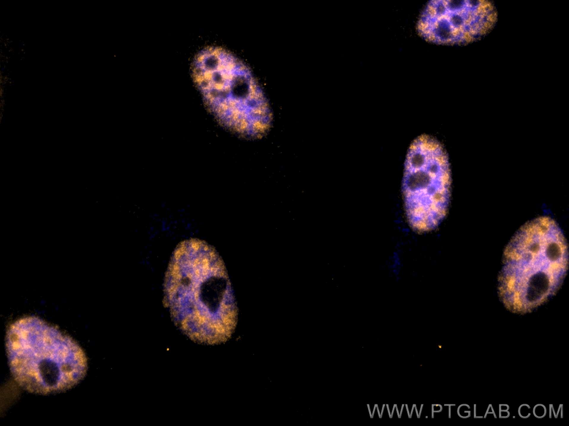 Immunofluorescence (IF) / fluorescent staining of HeLa cells using CoraLite®555-conjugated STK11/LKB1 Monoclonal anti (CL555-66719)