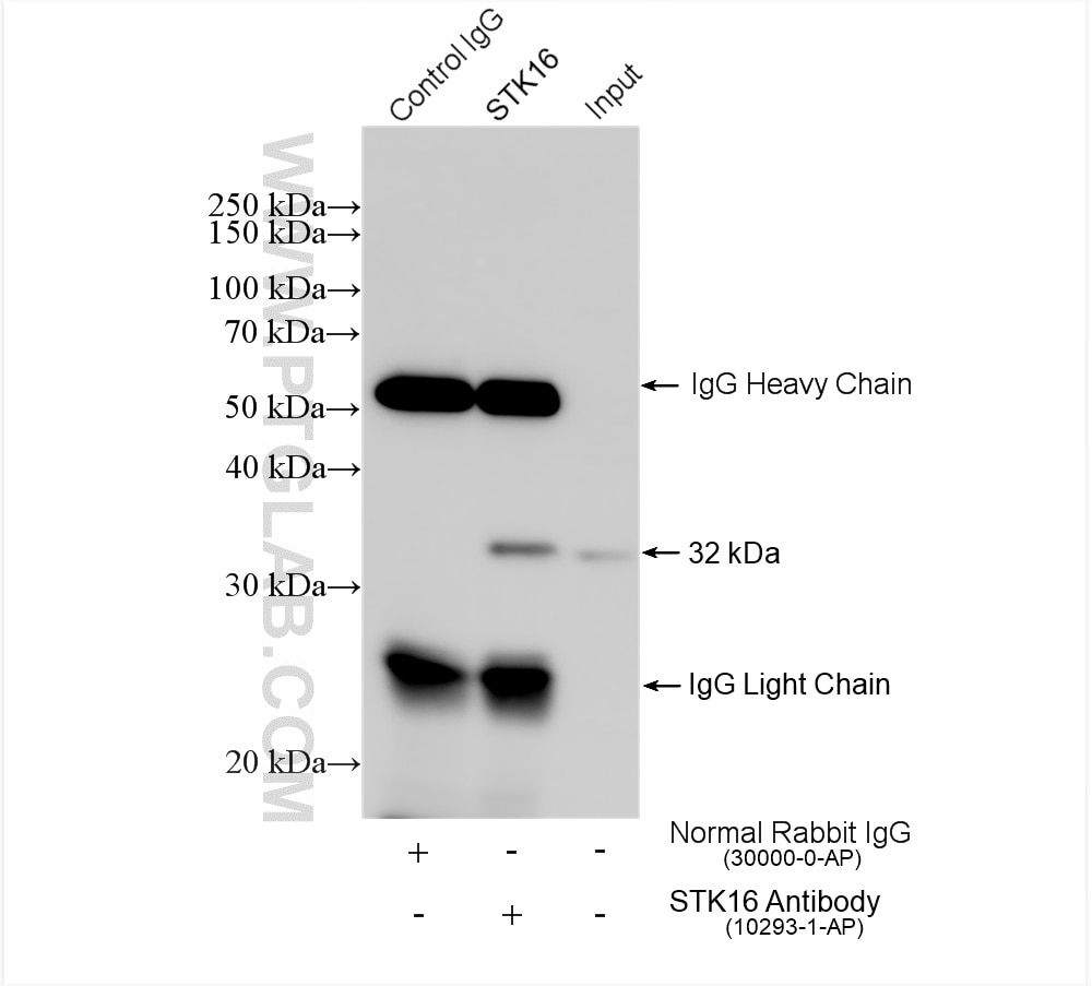 Immunoprecipitation (IP) experiment of mouse brain tissue using STK16 Polyclonal antibody (10293-1-AP)