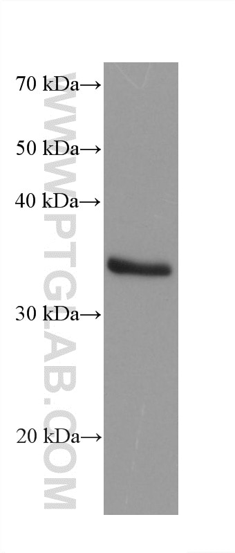 LNCaP cells were subjected to SDS PAGE followed by western blot with 60949-3-Ig (STK16 antibody) at dilution of 1:5000 incubated at room temperature for 1.5 hours. Western Blot (WB) analysis of LNCaP cells using STK16 Monoclonal antibody (60949-3-Ig)