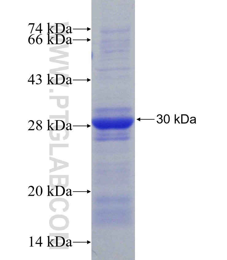 STK16 fusion protein Ag30523 SDS-PAGE