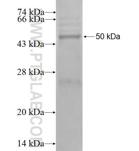 STK16 fusion protein Ag0339 SDS-PAGE