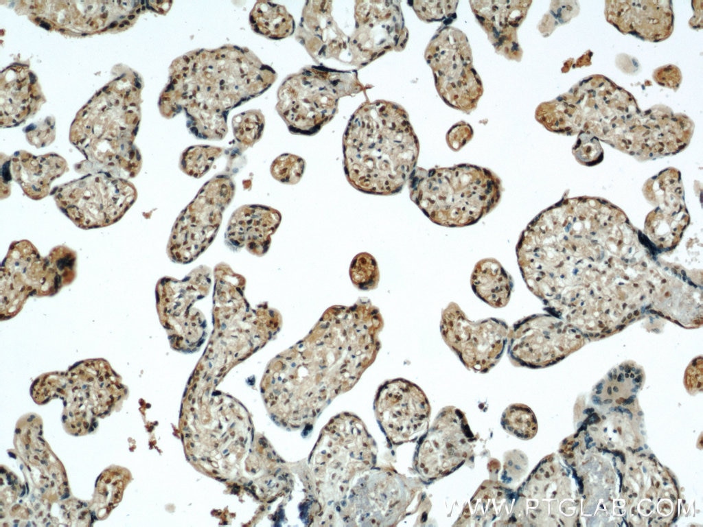 Immunohistochemistry (IHC) staining of human placenta tissue using STK17A Polyclonal antibody (14433-1-AP)