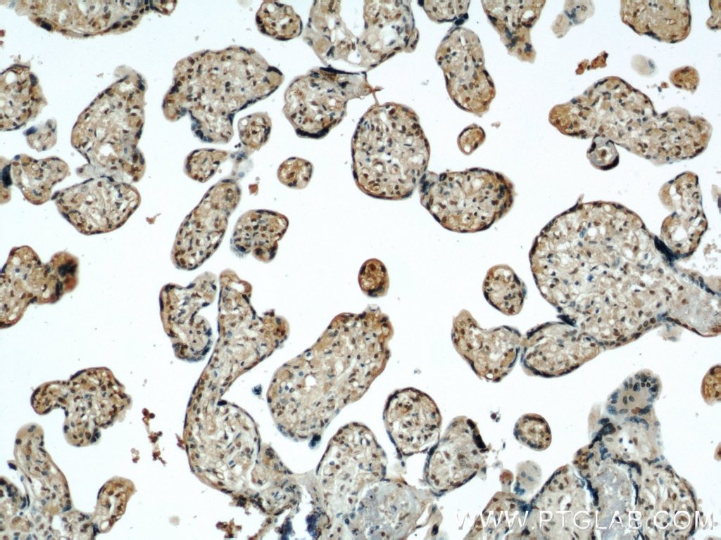 IHC staining of human placenta using 14433-1-AP