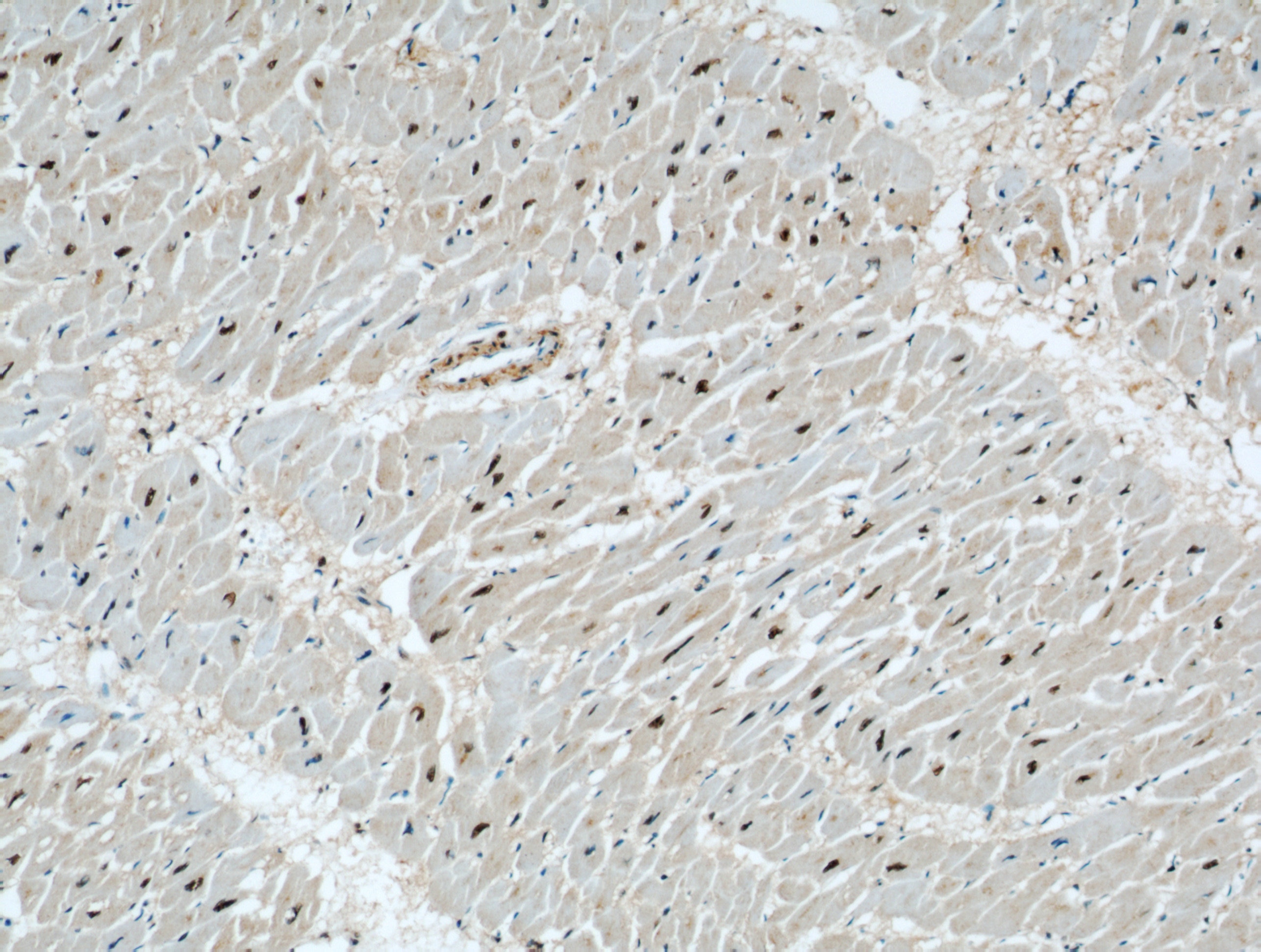 Immunohistochemistry (IHC) staining of human heart tissue using STK17A Polyclonal antibody (14433-1-AP)
