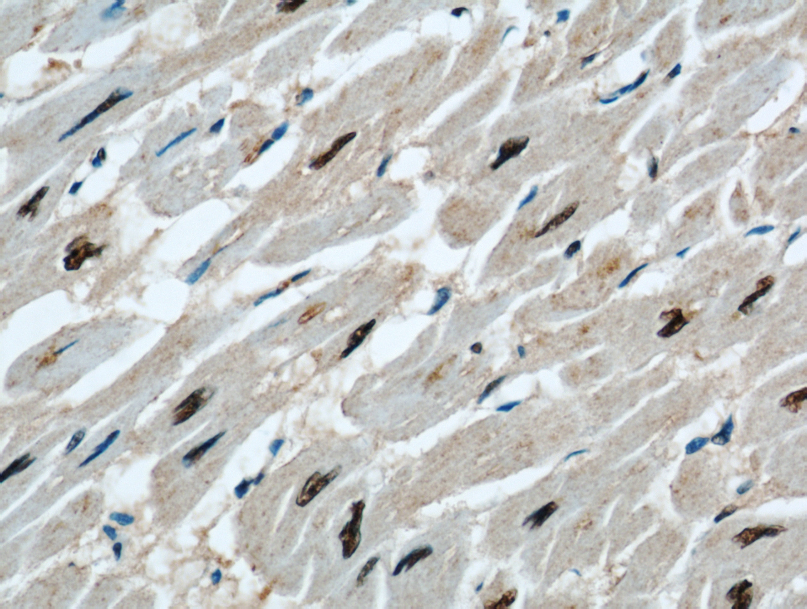 Immunohistochemistry (IHC) staining of human heart tissue using STK17A Polyclonal antibody (14433-1-AP)