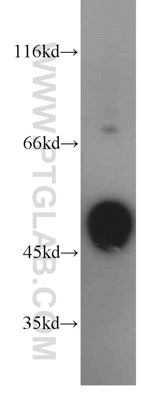 Western Blot (WB) analysis of human skeletal muscle tissue using STK17A Polyclonal antibody (14433-1-AP)