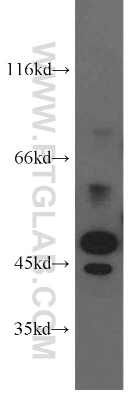 Western Blot (WB) analysis of NIH/3T3 cells using STK17A Polyclonal antibody (14433-1-AP)