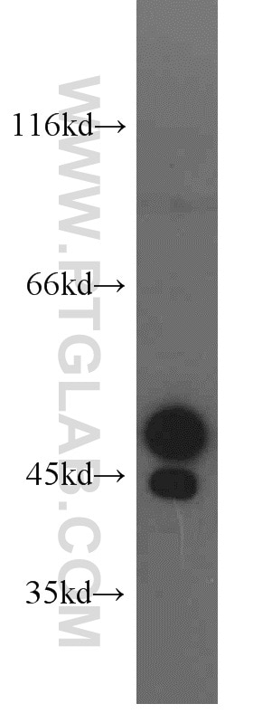 Western Blot (WB) analysis of BxPC-3 cells using STK17A Polyclonal antibody (14433-1-AP)