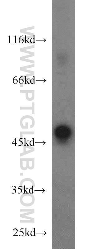 Western Blot (WB) analysis of mouse skeletal muscle tissue using STK17A Polyclonal antibody (14433-1-AP)