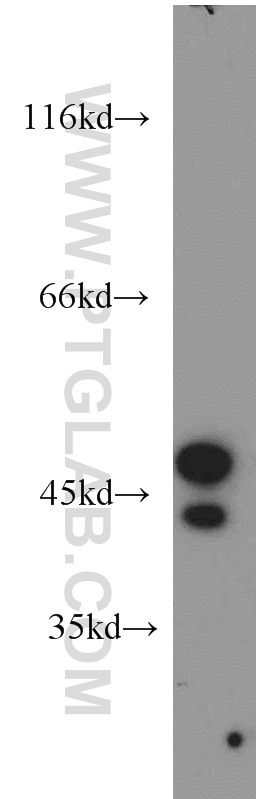 Western Blot (WB) analysis of BxPC-3 cells using STK17A Polyclonal antibody (14433-1-AP)