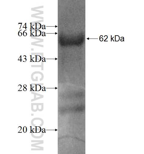 STK17A fusion protein Ag5811 SDS-PAGE