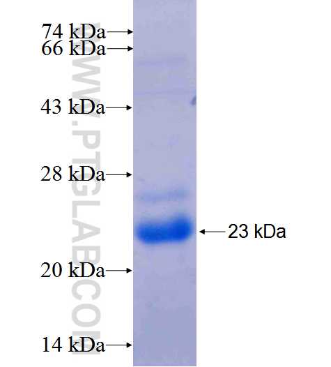STK17B fusion protein Ag24389 SDS-PAGE