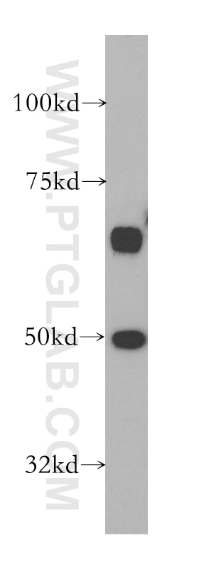 Western Blot (WB) analysis of HeLa cells using STK24 Polyclonal antibody (13579-1-AP)