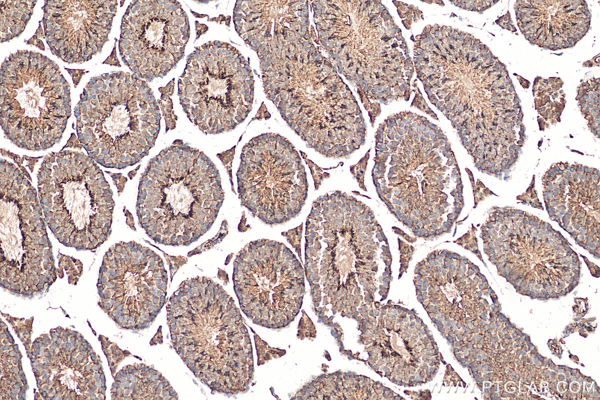 Immunohistochemistry (IHC) staining of mouse testis tissue using STK24 Polyclonal antibody (29846-1-AP)