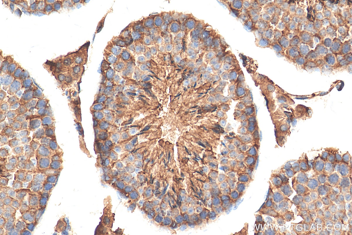 Immunohistochemistry (IHC) staining of mouse testis tissue using STK24 Polyclonal antibody (29846-1-AP)