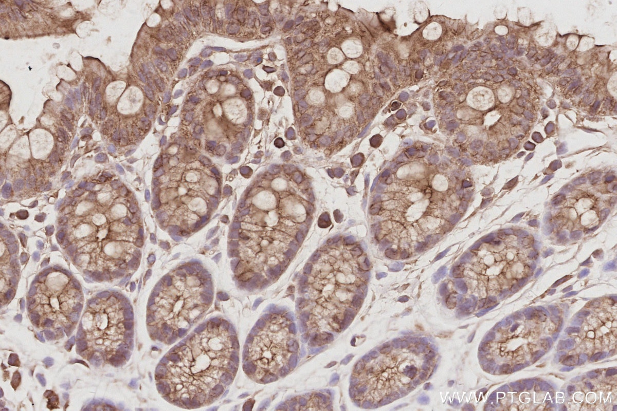 IHC staining of mouse colon using 29846-1-AP Immunohistochemistry (IHC) staining of mouse colon tissue using STK24 Polyclonal antibody (29846-1-AP)