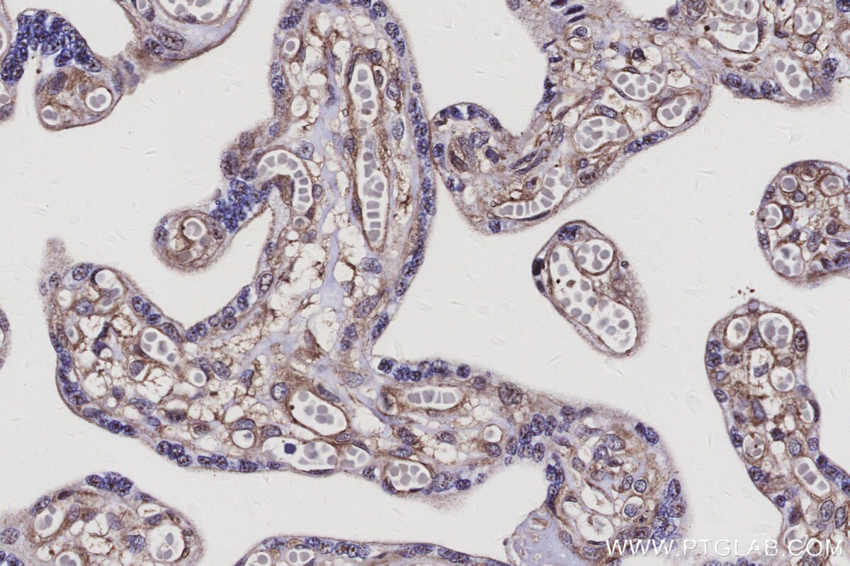 IHC staining of human placenta using 29846-1-AP Immunohistochemistry (IHC) staining of human placenta tissue using STK24 Polyclonal antibody (29846-1-AP)