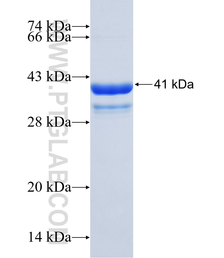 STK24 fusion protein Ag31519 SDS-PAGE
