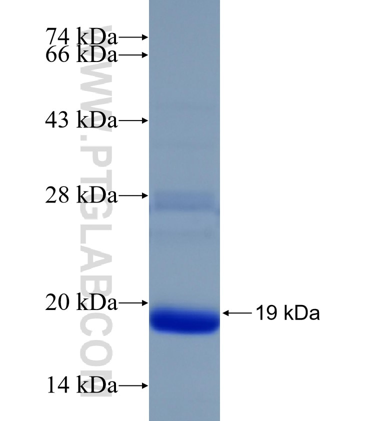 STK24 fusion protein Ag31526 SDS-PAGE