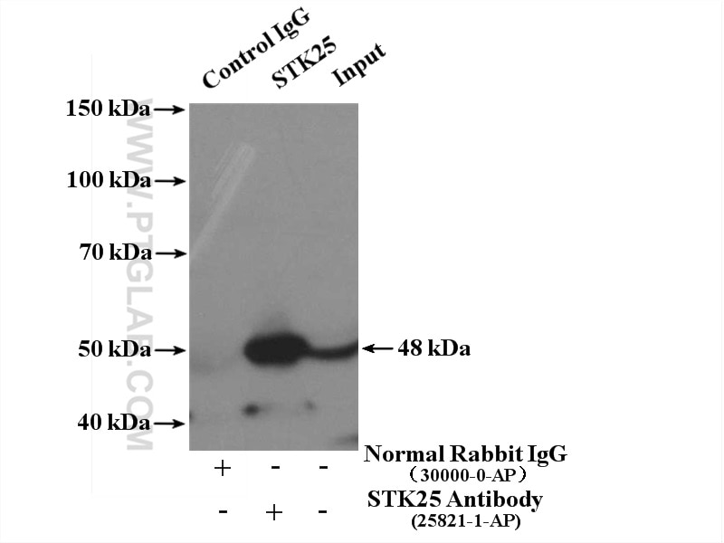 Immunoprecipitation (IP) experiment of mouse brain tissue using STK25 Polyclonal antibody (25821-1-AP)