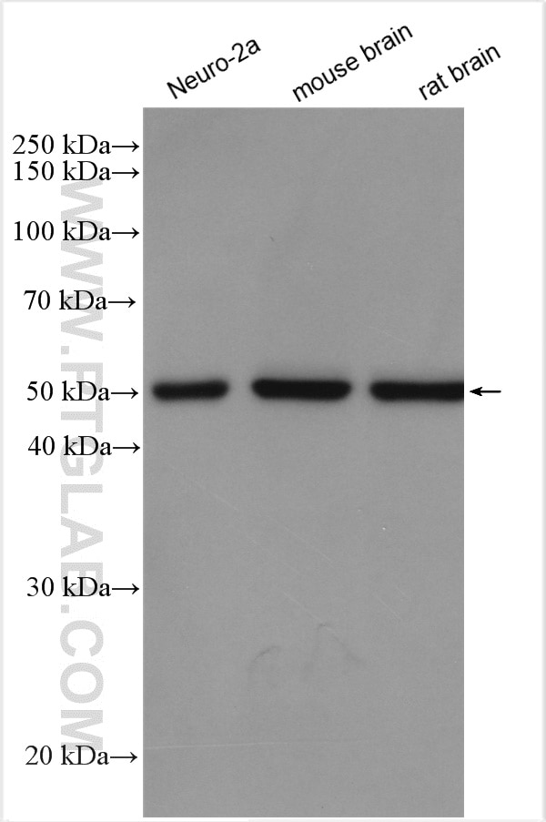 Western Blot (WB) analysis of various lysates using STK25 Polyclonal antibody (25821-1-AP)