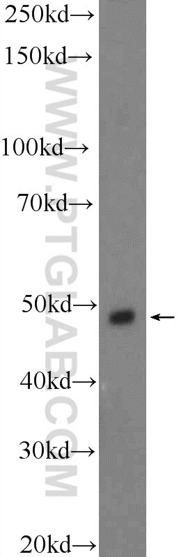 Western Blot (WB) analysis of Neuro-2a cells using STK25 Polyclonal antibody (25821-1-AP)