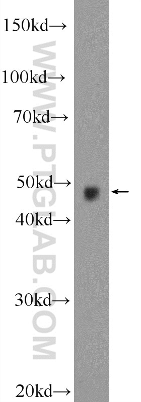 Western Blot (WB) analysis of mouse brain tissue using STK25 Polyclonal antibody (25821-1-AP)