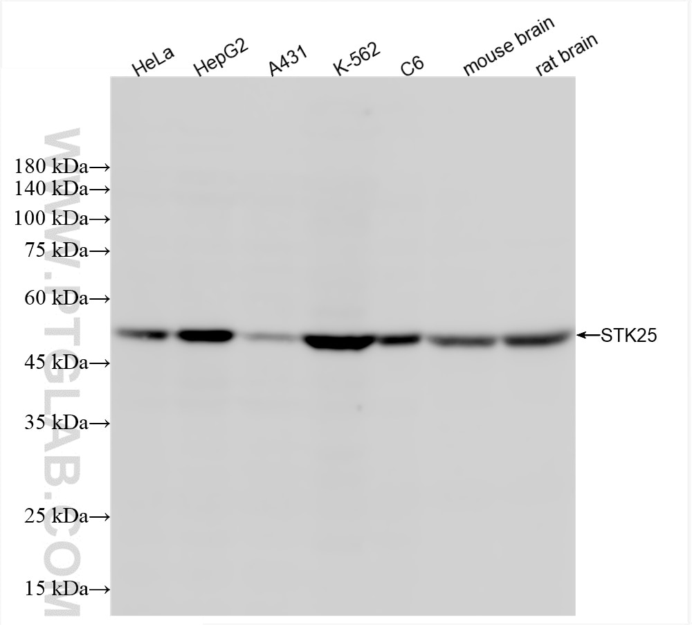 STK25