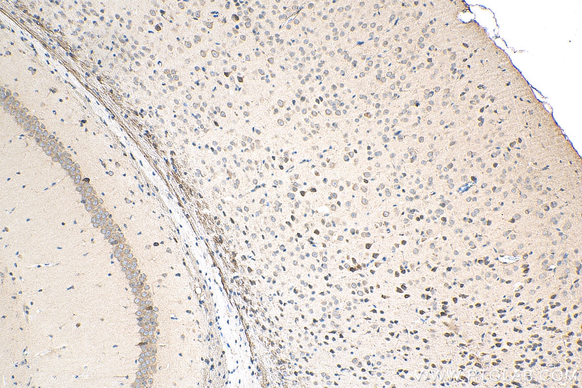 Immunohistochemistry (IHC) staining of mouse brain tissue using Biotin-conjugated STK25 Polyclonal antibody (Biotin-25821)