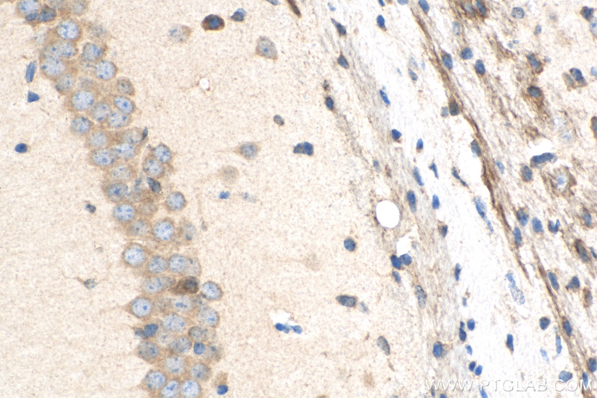 Immunohistochemistry (IHC) staining of mouse brain tissue using Biotin-conjugated STK25 Polyclonal antibody (Biotin-25821)