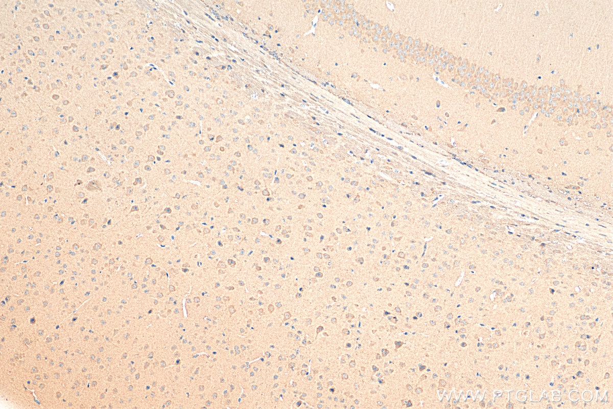 Immunohistochemistry (IHC) staining of mouse brain tissue using Biotin-conjugated STK25 Polyclonal antibody (Biotin-25821)