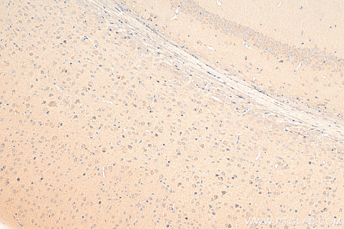 IHC staining of mouse brain using Biotin-25821