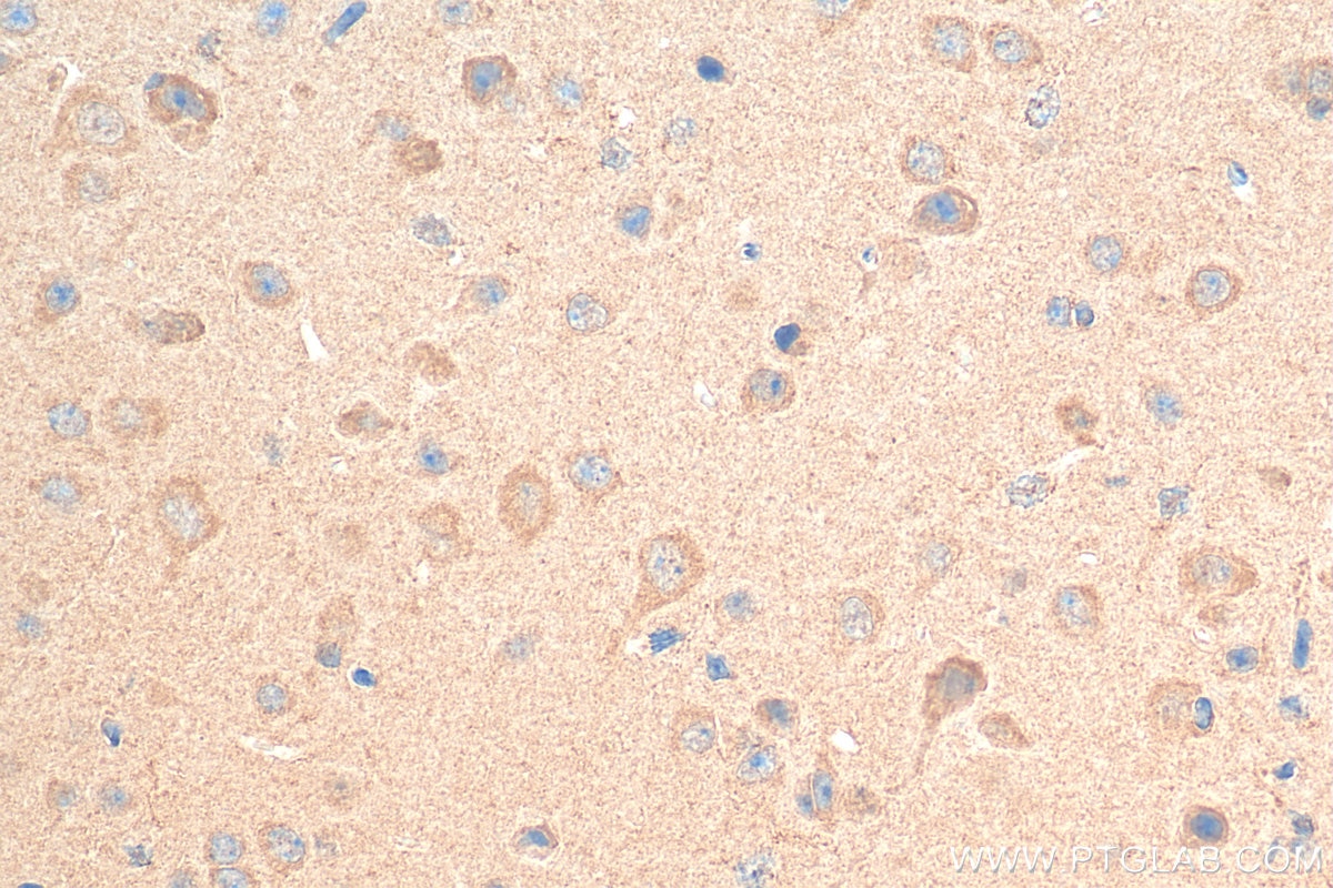 IHC staining of mouse brain using Biotin-25821