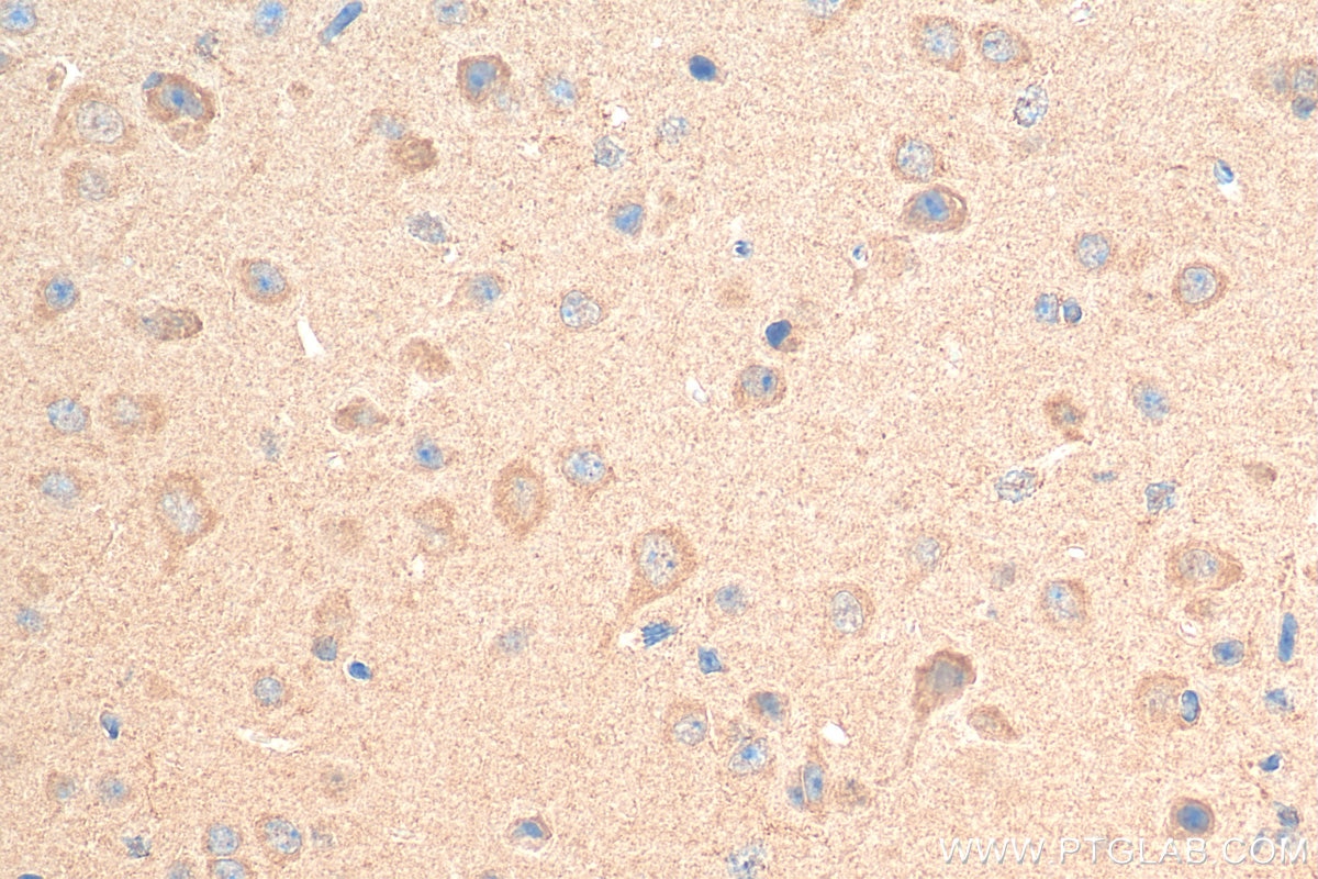 Immunohistochemistry (IHC) staining of mouse brain tissue using Biotin-conjugated STK25 Polyclonal antibody (Biotin-25821)