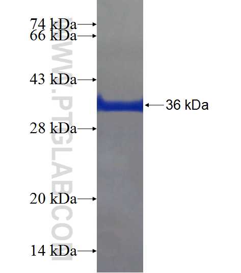 STK25 fusion protein Ag22964 SDS-PAGE
