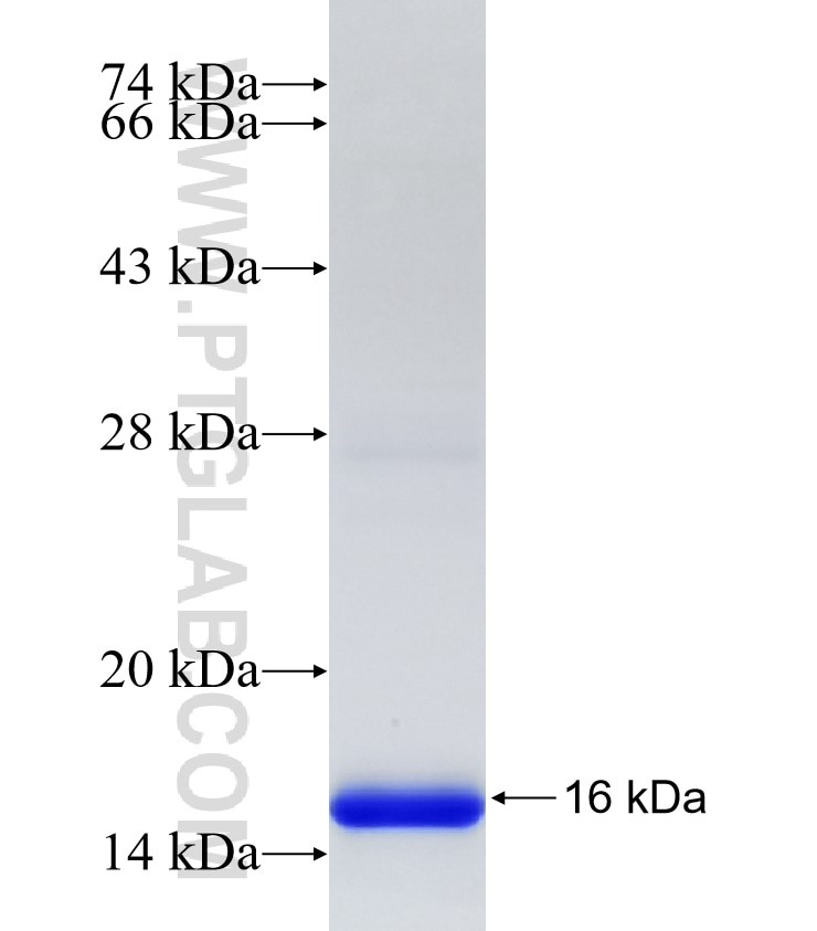 STK25 fusion protein Ag33092 SDS-PAGE STK25 fusion protein Ag33092 SDS-PAGE